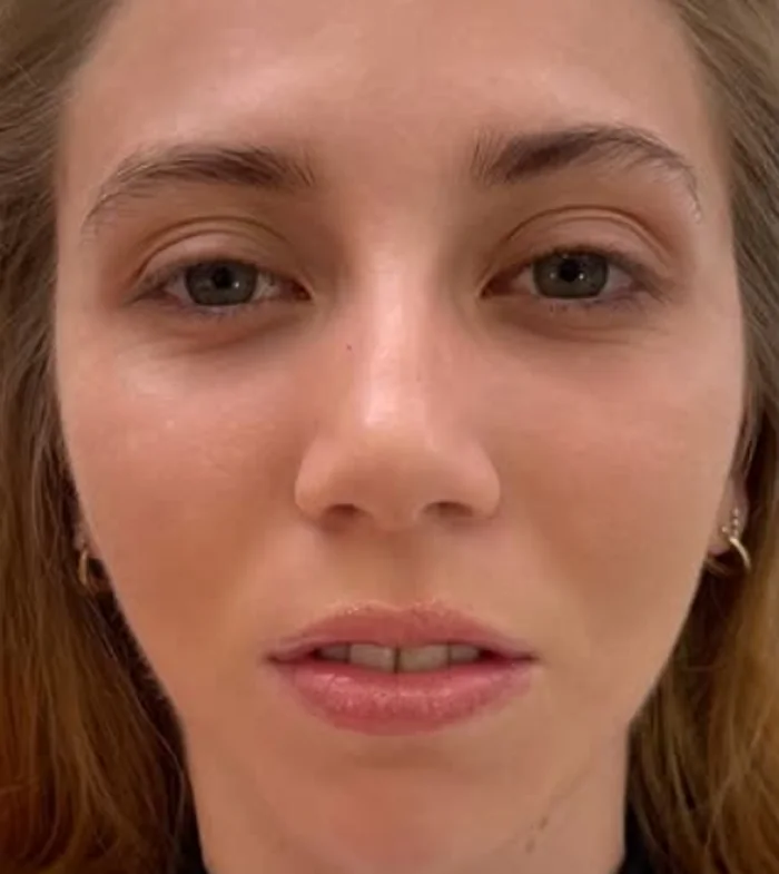Before lash lift and HD brow sculpt