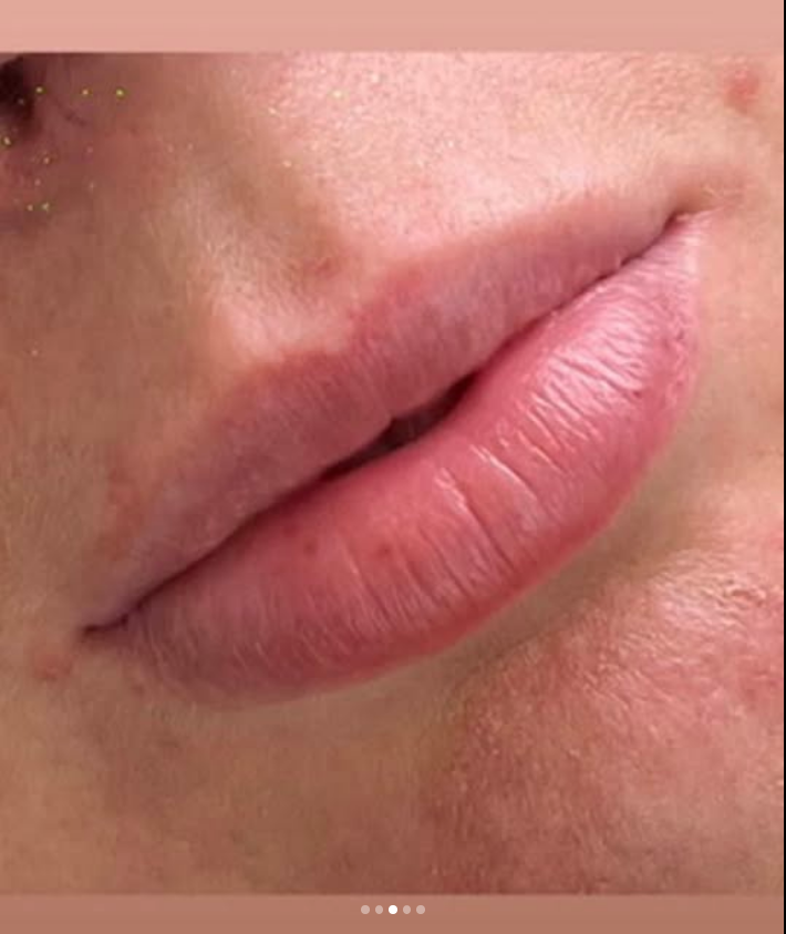 Under eye treatment detail