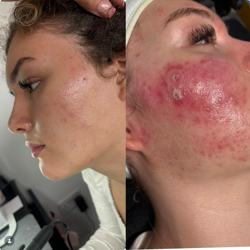 Facial Aesthetics