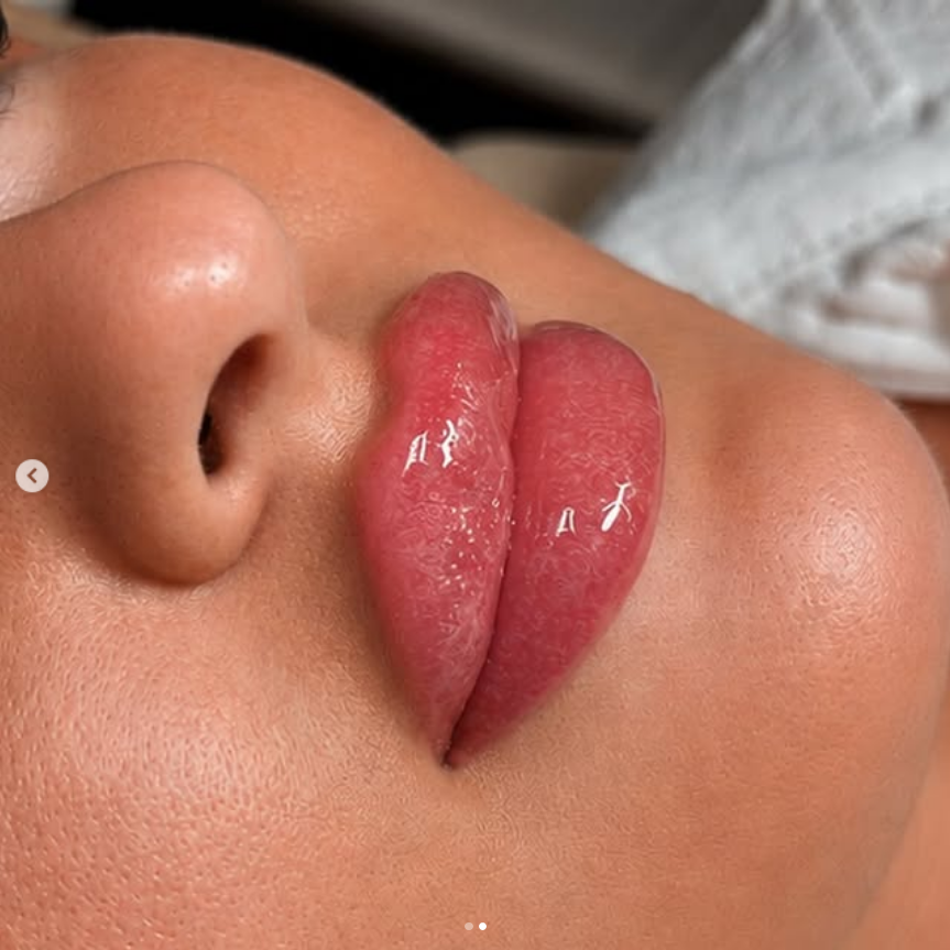 Beauty Treatments