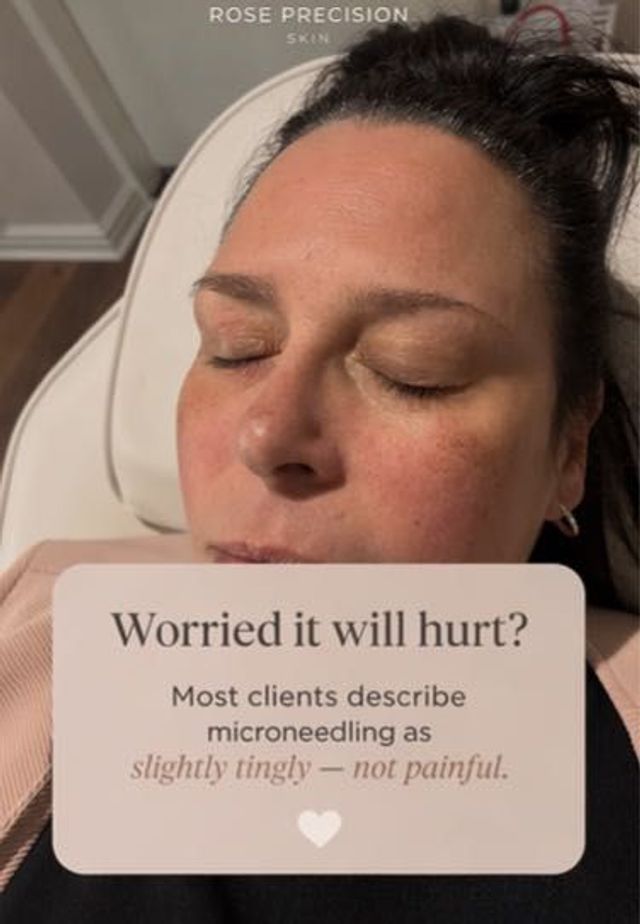 Precision skin renewal treatment at Rose Precision Skin