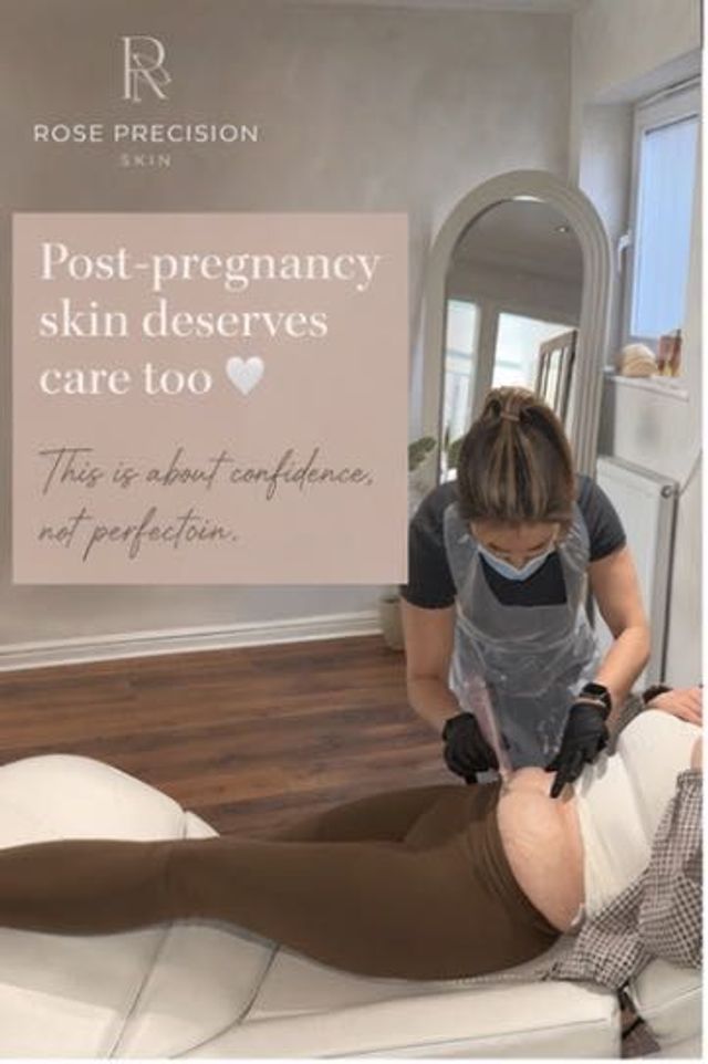 Microneedling Mum Tum