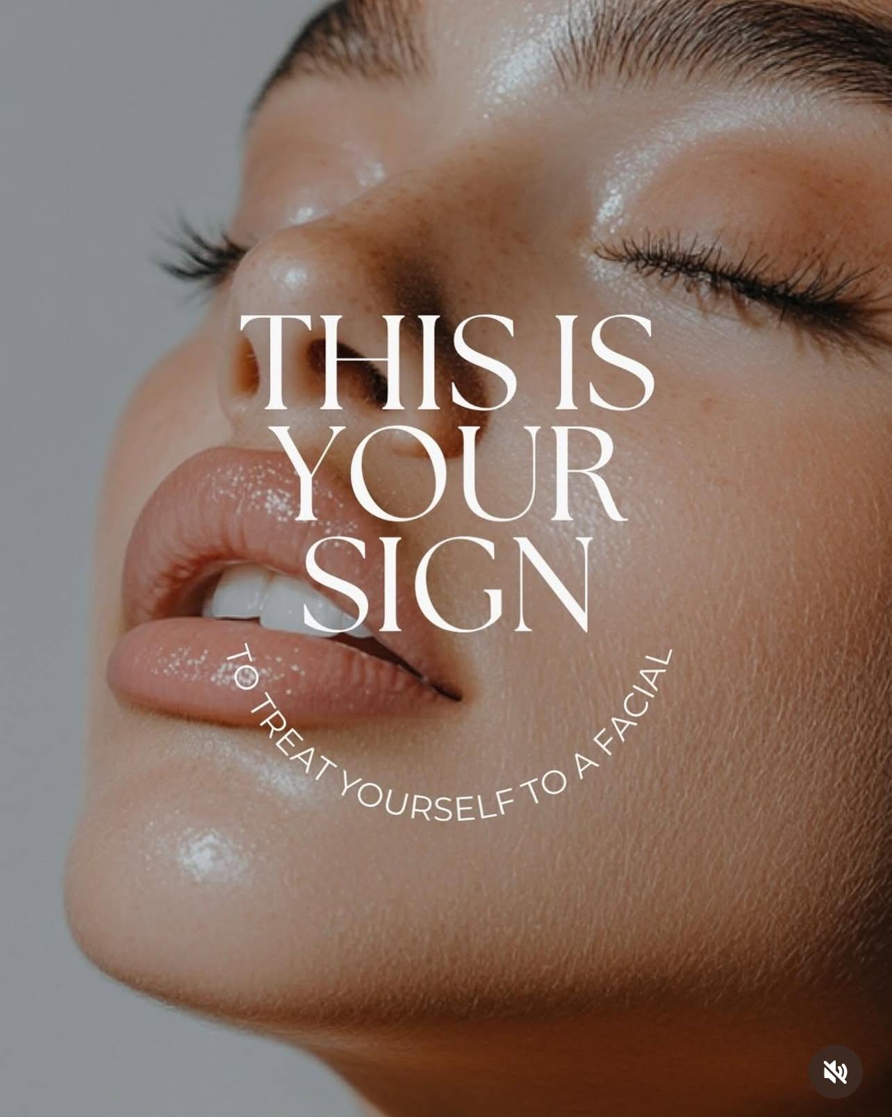 Microneedling